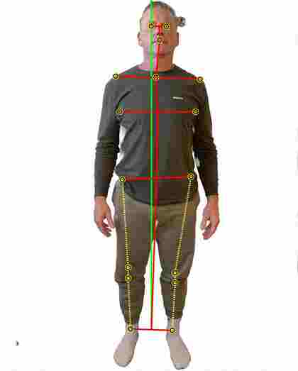 biomechanical posture photograph, front
